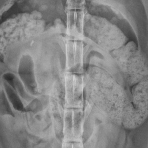 OER Case 13
