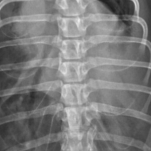 OER Case 14