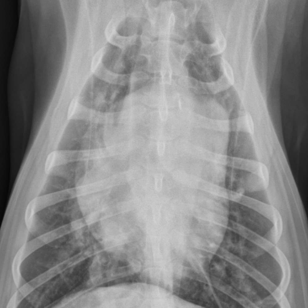 Infectious Diseases: Dirofilariasis